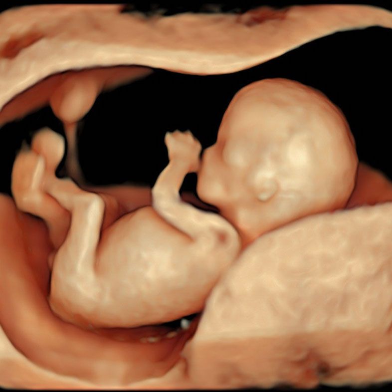 Early-pregnancy-scans-12wk-3D-1-0bcec9db